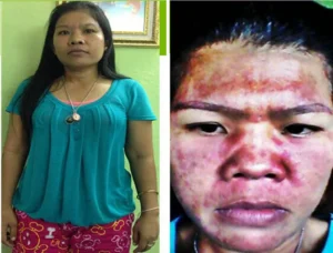 คุณคำพัน จันดีทอง นักธุรกิจ Herbalife